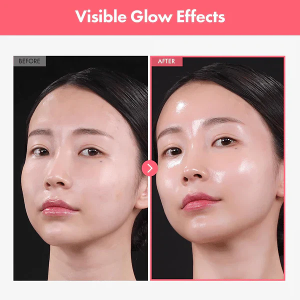 Arbutin 7% + Tranexamic Acid 4% Cream - Image 4