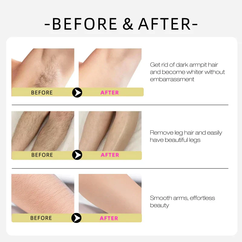 SmoothSkin Hair-Reducing Oil - Image 4