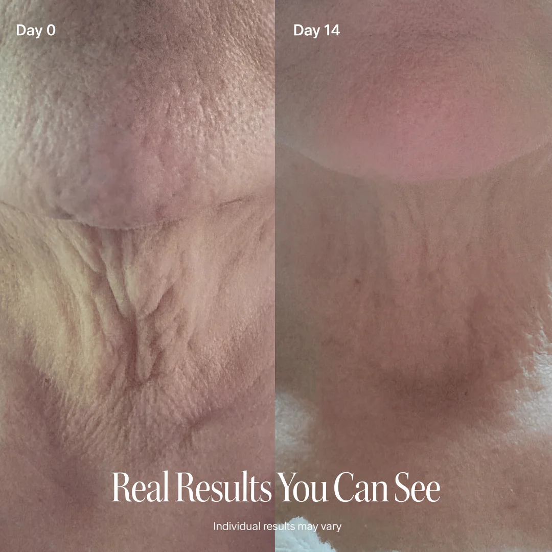 LAZZDA NECK FIRMING CREAM - Image 4