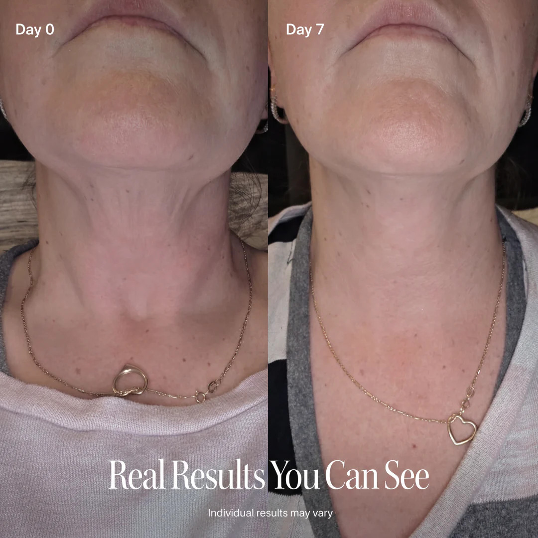 LAZZDA NECK FIRMING CREAM - Image 5