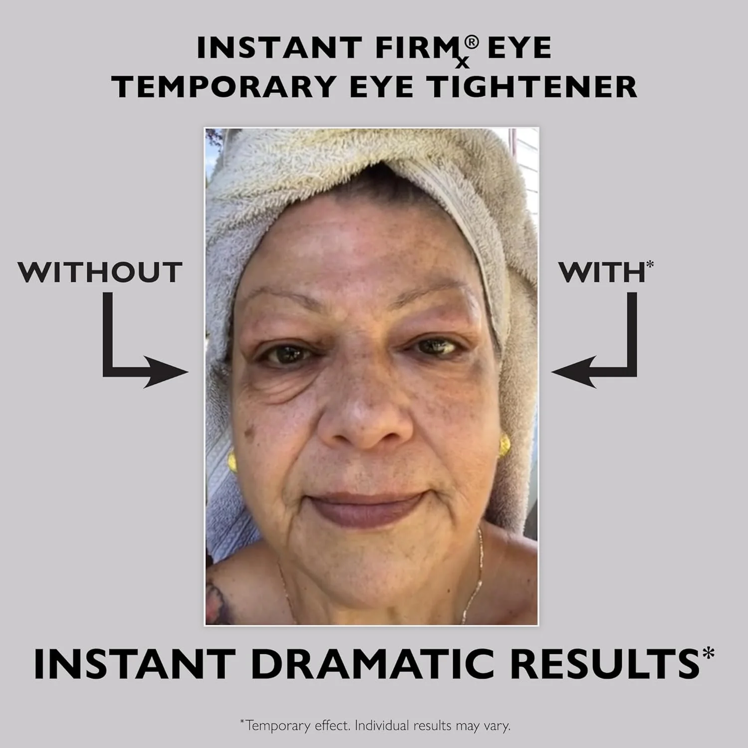 Temporary Face Tightener - Image 6